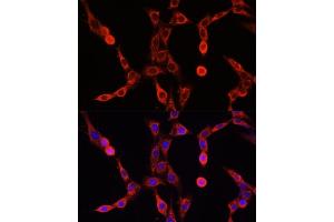 Immunofluorescence (IF) image for anti-ATP-Binding Cassette, Sub-Family D (Ald), Member 1 (ABCD1) (AA 340-500) antibody (ABIN6136369)