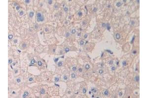 Detection of CRKL in Human Liver Tissue using Polyclonal Antibody to Crk Like Protein (CRKL) (CrkL 抗体  (AA 1-303))