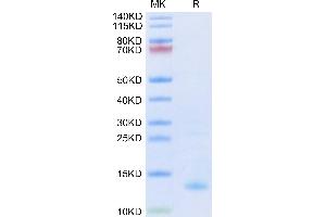 SDS-PAGE (SDS) image for Platelet Factor 4 (PF4) (AA 32-101) protein (His-Avi Tag,Biotin) (ABIN7274448)