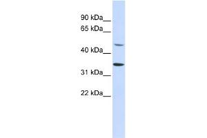 WB Suggested Anti-ZNF398 Antibody Titration:  0. (ZNF398 抗体  (Middle Region))
