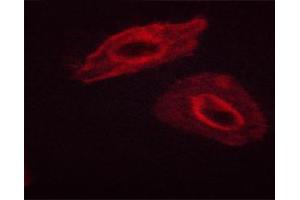 ABIN6267311 staining Hela cells by ICC/IF.