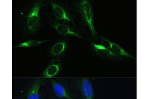 Immunofluorescence analysis of U-2 OS cells using BRK1 Polyclonal Antibody at dilution of 1:100. (BRK1 抗体)