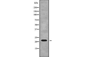 Western blot analysis of RPL18A using A549 whole cell lysates (RPL18A 抗体  (Internal Region))