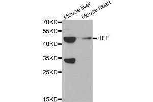 Western blot analysis of extracts of mouse brain and mouse heart tissues, using HFE antibody. (HFE 抗体)