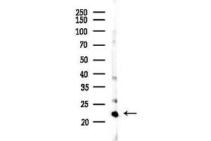 anti-Glucosamine-Phosphate N-Acetyltransferase 1 (GNPNAT1) (N-Term) antibody