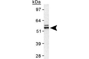 Western blot analysis of TERF2 in HeLa nuclear extract using TERF2 polyclonal antibody . (TRF2 抗体)