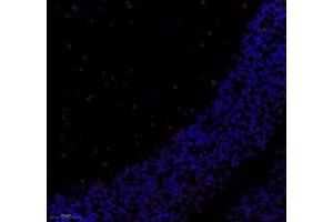 Immunofluorescence of paraffin embedded mouse cerebellum using notch3 (ABIN7074862) at dilution of 1:650 (250x lens) (NOTCH3 抗体)