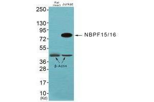 Western blot analysis of extracts from JK cells, using NBPF1/9/10/12/14/15/16/20 antibody. (NBPF12/NBPF1/NBPF1/NBPF9 抗体)