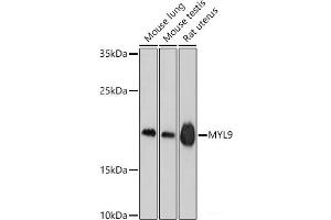 Western blot analysis of extracts of various cell lines using MYL9 Polyclonal Antibody at dilution of 1:1000. (MYL9 抗体)