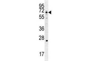 Western Blotting (WB) image for anti-Glutamate-Cysteine Ligase, Catalytic Subunit (GCLC) (AA 1-30) antibody (ABIN3031076)