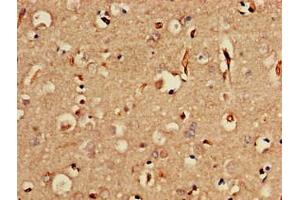 Immunohistochemistry of paraffin-embedded human brain tissue using ABIN7175662 at dilution of 1:100 (SORCS2 抗体  (AA 712-786))