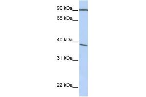 WB Suggested Anti-POPDC3 Antibody Titration:  0.