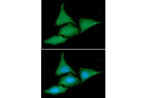 anti-BCL2-Associated Athanogene 2 (BAG2) (AA 1-211) antibody