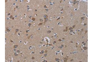 The image on the left is immunohistochemistry of paraffin-embedded Human brain tissue using ABIN7129900(INSIG2 Antibody) at dilution 1/30, on the right is treated with fusion protein. (INSIG2 抗体)