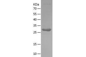 Western Blotting (WB) image for Galectin 3 (LGALS3) (AA 2-262) protein (His tag) (ABIN7123045) (Galectin 3 Protein (LGALS3) (AA 2-262) (His tag))