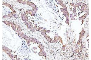 IHC analysis of EIF4A using anti-EIF4A antibody (ABIN7601309).