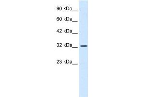 WB Suggested Anti-SMARCA2 Antibody Titration:  0.