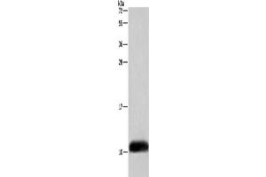 Gel: 10 % SDS-PAGE, Lysate: 40 μg, Lane: A549 cells, Primary antibody: ABIN7129016(COX6B2 Antibody) at dilution 1/500, Secondary antibody: Goat anti rabbit IgG at 1/8000 dilution, Exposure time: 5 seconds (COX6B2 抗体)