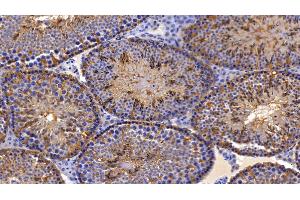 Immunohistochemistry (IHC) image for anti-Peroxiredoxin 2 (PRDX2) (AA 6-164) antibody (ABIN7436132)
