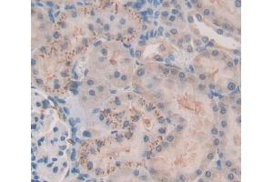 Used in DAB staining on fromalin fixed paraffin- embedded kidney tissue (FASTK 抗体  (AA 330-511))