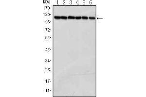 Western blot analysis using PARP mouse mAb against Jurkat (1), K562 (2), Hela (3), Raji (4),THP-1 (5) and SW620 (6) cell lysate.