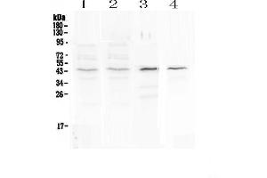 Western blot analysis of SP6 using anti-SP6 antibody . (SP6 抗体)