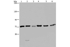 Western Blot analysis of K562, A549, HT-29, 293T, Hela and Jurkat cell using KARS Polyclonal Antibody at dilution of 1:350 (KARS 抗体)
