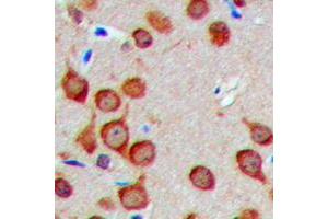 Immunohistochemical analysis of Fusion 1 staining in human brain formalin fixed paraffin embedded tissue section. (TUSC2 抗体  (Center))