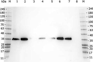 Western Blotting (WB) image for anti-Voltage-Dependent Anion Channel 1 (VDAC1) (AA 175-200) antibody (ABIN129654)