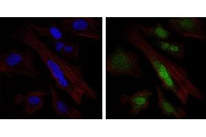 Image no. 1 for anti-SRY (Sex Determining Region Y)-Box 9 (SOX9) antibody (ABIN1501087) (SOX9 抗体)