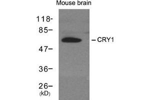 Western blot analysis of extracts from mouse brain tissue using CRY1 antibody. (CRY1 抗体)