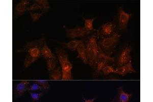 Immunofluorescence analysis of HeLa cells using DMD Polyclonal Antibody at dilution of 1:100. (Dystrophin 抗体)