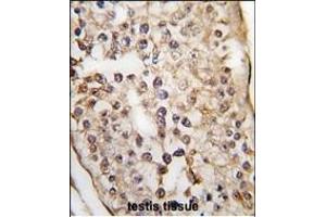 Formalin-fixed and paraffin-embedded human testis tissue reacted with PUM2 Antibody (C-term) (ABIN391821 and ABIN2841667) , which was peroxidase-conjugated to the secondary antibody, followed by DAB staining. (PUM2 抗体  (N-Term))