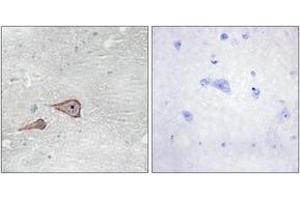 Immunohistochemistry analysis of paraffin-embedded human brain tissue, using CDH3 Antibody. (P-Cadherin 抗体  (AA 51-100))
