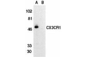 Western blot analysis of CX3CR1 in THP-1 cell lysate in the absence (lane A) or presence (lane B) of blocking peptide with AP30265PU-N CX3CR1 antibody at 1/500 dilution. (CX3CR1 抗体  (Extracellular Loop))