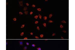 Immunofluorescence analysis of L929 cells using IFT88 Polyclonal Antibody at dilution of 1:100. (IFT88 抗体)