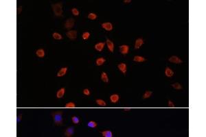Immunofluorescence analysis of L929 cells using IFT88 Polyclonal Antibody at dilution of 1:100. (IFT88 抗体)