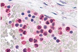 Human Neutrophils: Formalin-Fixed, Paraffin-Embedded (FFPE) (TLR4 抗体  (C-Term))