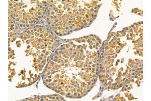 IL12B Mouse Monoclonal Antibody at 1/100 staining mouse testis tissue by IHC-P.
