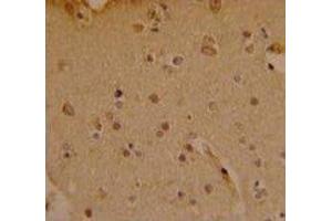 Immunohistochemistry (IHC) image for anti-SRY (Sex Determining Region Y)-Box 4 (SOX4) (AA 86-114) antibody (ABIN3032699)