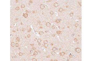 Immunohistochemistry of paraffin-embedded Rat brain using KCNJ4 Polyclonal Antibody at dilution of 1:100 (40x lens). (KCNJ4 抗体)