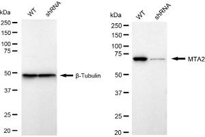 Western blotting analysis using MTA2 antibody (ABIN7799378). (Recombinant MTA2 抗体)