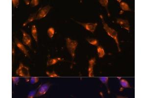 Immunofluorescence analysis of L929 cells using SSTR2 Polyclonal Antibody at dilution of 1:100 (40x lens). (SSTR2 抗体)