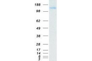 Validation with Western Blot