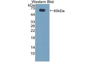 Western Blotting (WB) image for anti-Cartilage Intermediate Layer Protein, Nucleotide Pyrophosphohydrolase (CILP) (AA 604-864) antibody (ABIN1858409) (CILP 抗体  (AA 604-864))
