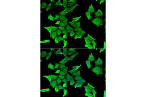 Immunofluorescence analysis of HeLa cells using SPINT2 antibody. (SPINT2 抗体)
