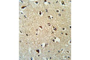 Immunohistochemistry (Paraffin-embedded Sections) (IHC (p)) image for anti-rho GDP Dissociation Inhibitor (GDI) alpha (ARHGDIA) (AA 112-140), (C-Term) antibody (ABIN389429)