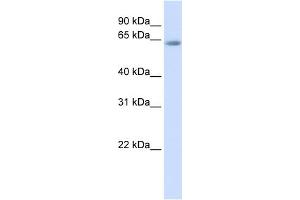 Western Blotting (WB) image for anti-Transcription Factor 7-Like 2 (T-Cell Specific, HMG-Box) (TCF7L2) (Middle Region) antibody (ABIN2777927)