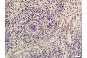 Formalin-fixed and paraffin embedded mouse embryo labeled with Rabbit Anti-CDK7 Polyclonal Antibody, Unconjugated (ABIN670251) at 1:200 followed by conjugation to the secondary antibody and DAB staining (CDK7 抗体  (AA 1-80))