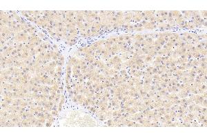 Detection of HSPb2 in Human Liver Tissue using Polyclonal Antibody to Heat Shock Protein Beta 2 (HSPb2) (HSPB2 抗体  (AA 12-182))